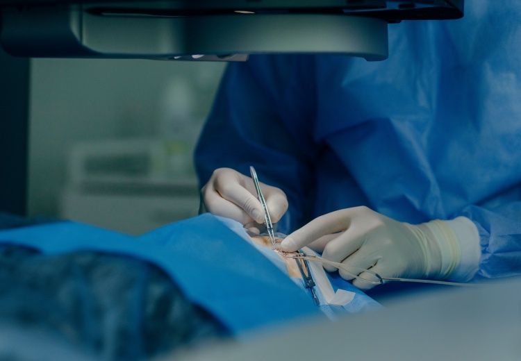 Préparer et réussir son opération du glaucome après 60 ans - Heyme